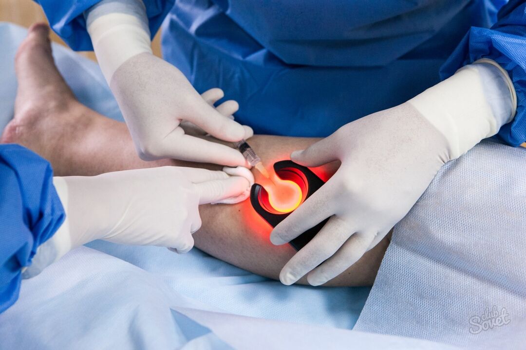 Varicose veins on the legs diagnostics