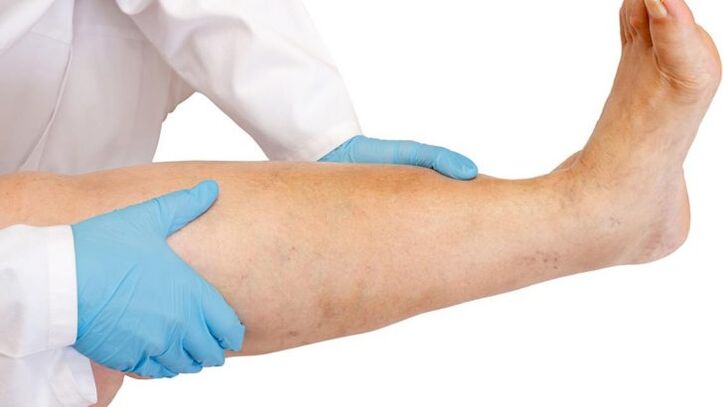 how to identify the disease